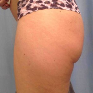 ava md results